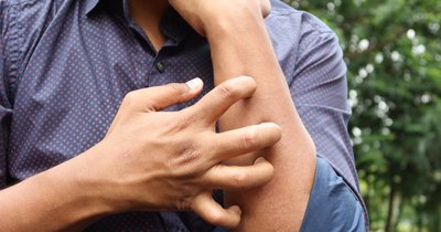 Alergia na tkaniny: objawy i rozwiązania