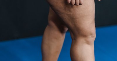 Ćwiczenia na mięśnie ud wewnętrznych